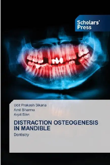 Distraction Osteogenesis in Mandible by Udit Prakash Sikaria