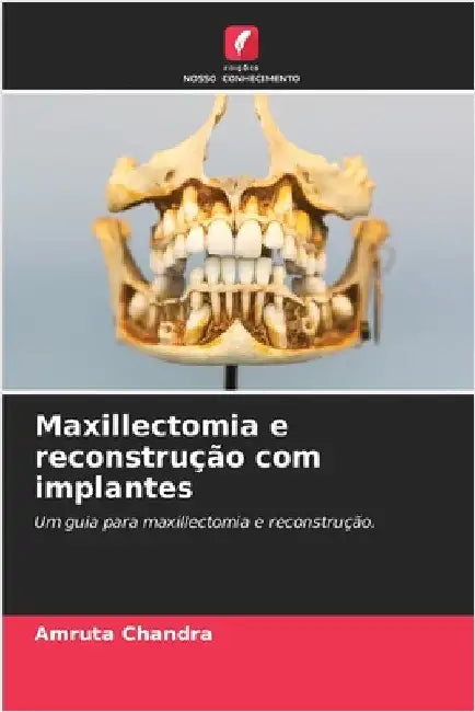 Maxillectomia e reconstrução com implantes by Chandra, Amruta