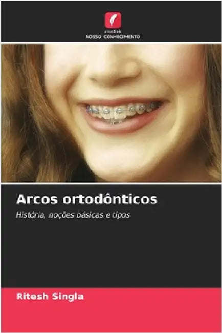 Arcos ortodônticos by Singla, Ritesh