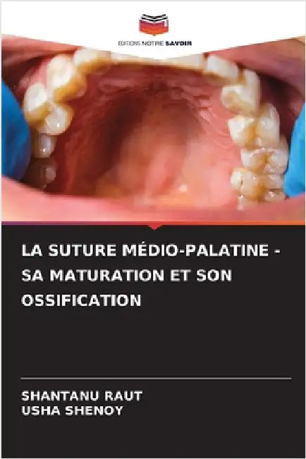 La Suture Médio-Palatine - Sa Maturation Et Son Ossification by Raut, Shantanu