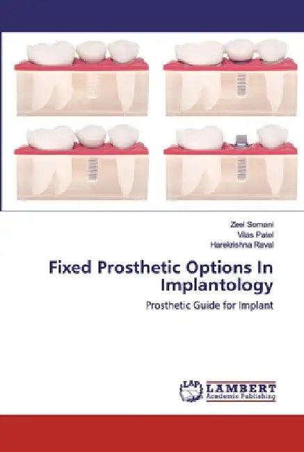 Fixed Prosthetic Options In Implantology by Zeel Somani