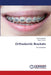 Orthodontic Brackets by Pranshu Mathur