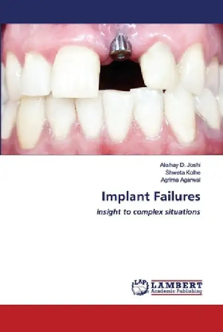 Implant Failures by Akshay D. Joshi