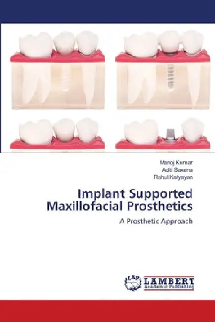 Implant Supported Maxillofacial Prosthetics by Manoj Kumar