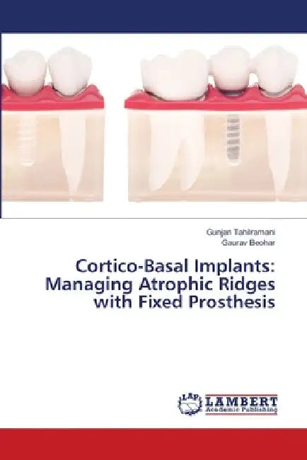 Cortico-Basal Implants: Managing Atrophic Ridges with Fixed Prosthesis by Gunjan Tahilramani