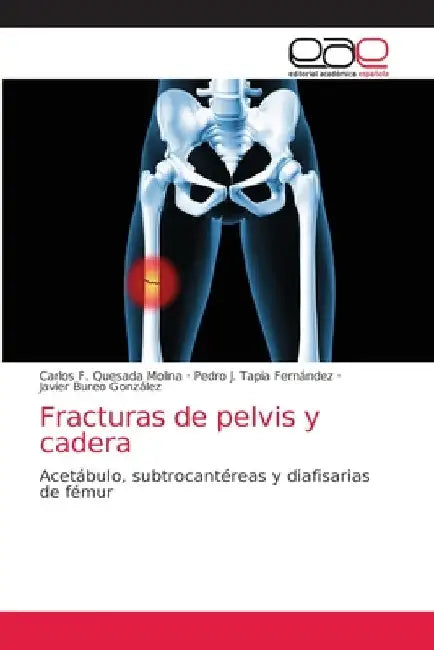 Fracturas de pelvis y cadera by Carlos F. Quesada Molina