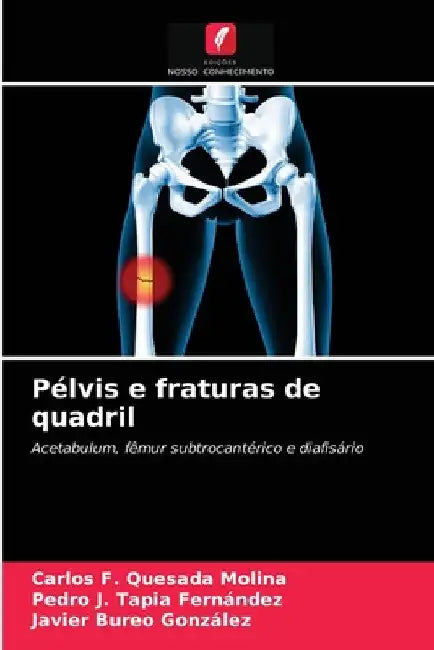 Pélvis e fraturas de quadril by Carlos F. Quesada Molina