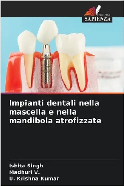 Impianti dentali nella mascella e nella mandibola atrofizzate by Singh, Ishita