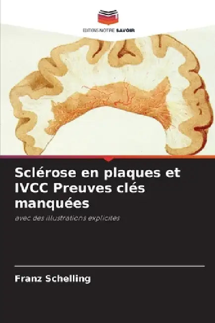 Sclérose en plaques et IVCC Preuves clés manquées by Franz Schelling