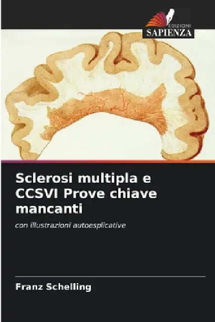 Sclerosi multipla e CCSVI Prove chiave mancanti by Franz Schelling