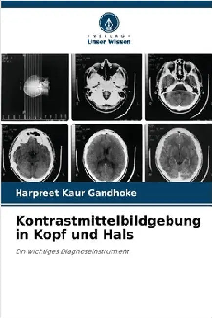 Kontrastmittelbildgebung in Kopf und Hals by Gandhoke, Harpreet Kaur