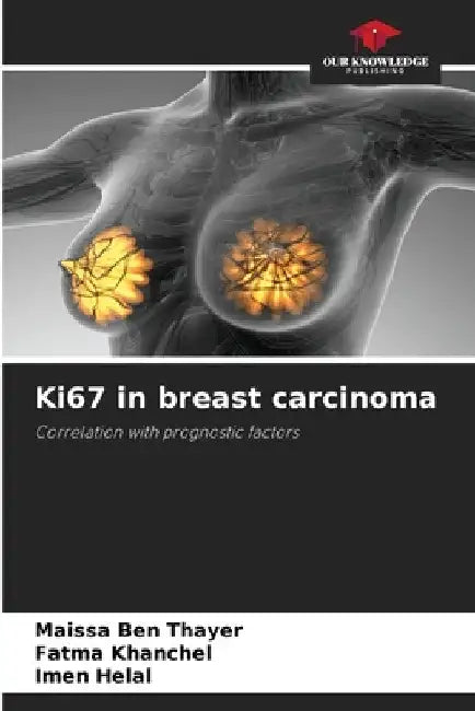 Ki67 in breast carcinoma by Maissa Ben Thayer