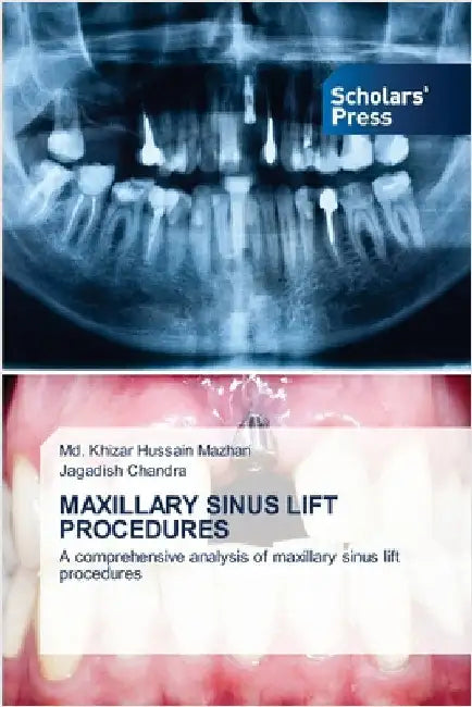 Maxillary Sinus Lift Procedures by Mazhari, MD Khizar Hussain