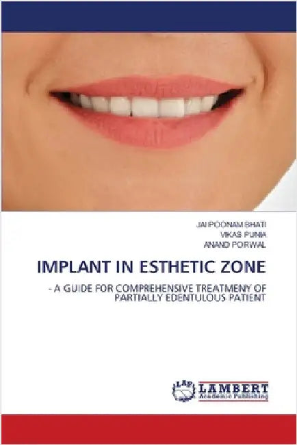 Implant in Esthetic Zone by Jai Poonam Bhati