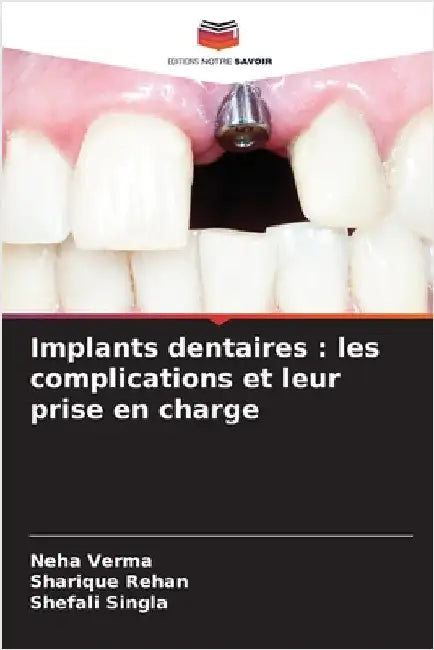 Implants dentaires: les complications et leur prise en charge by Verma, Neha