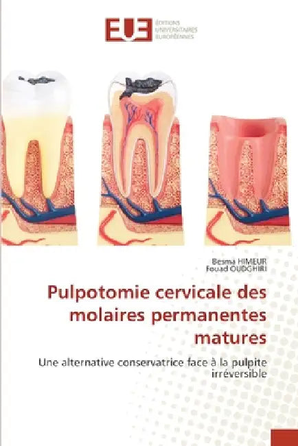 Pulpotomie cervicale des molaires permanentes matures by Besma Himeur, Fouad Oudghiri