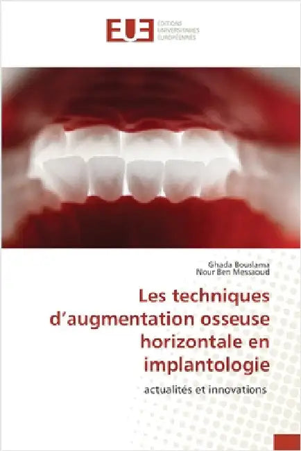 Les techniques d'augmentation osseuse horizontale en implantologie by Bouslama, Ghada