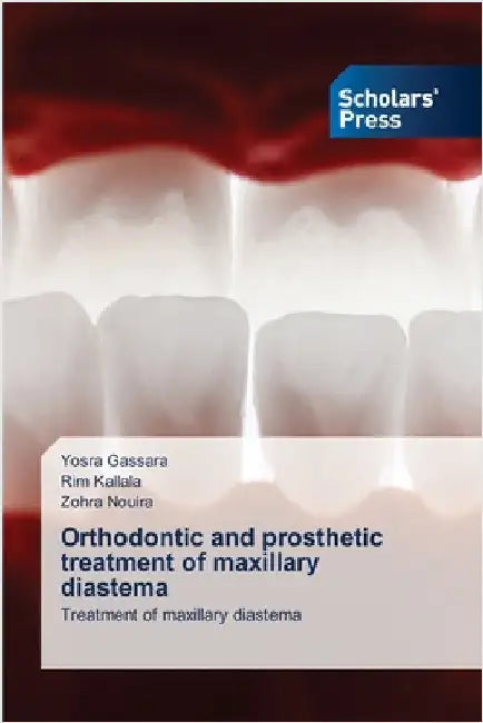 Orthodontic and prosthetic treatment of maxillary diastema by Yosra Gassara