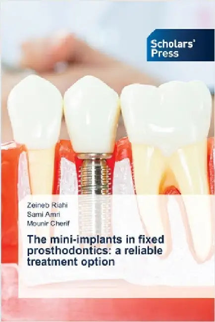 The mini-implants in fixed prosthodontics: a reliable treatment option by Riahi, Zeineb