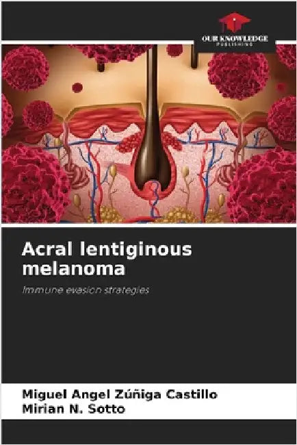 Acral lentiginous melanoma by Zúñiga Castillo, Miguel Angel