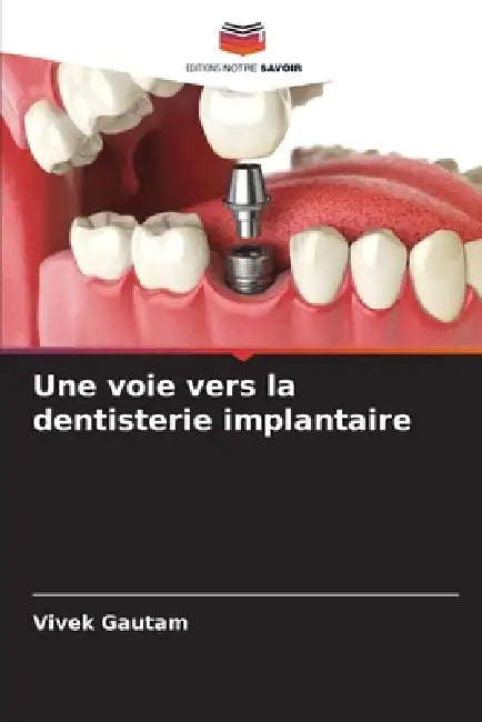 Une voie vers la dentisterie implantaire by Vivek Gautam