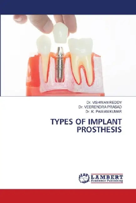 Types of Implant Prosthesis by Vishwan Reddy, Veerendra Prasad, K. Pawan Kumar