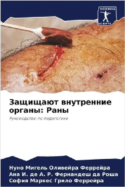 Защищают внутренние орг& by Ферреl