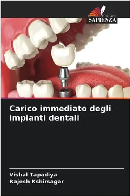 Carico immediato degli impianti dentali by Tapadiya, Vishal