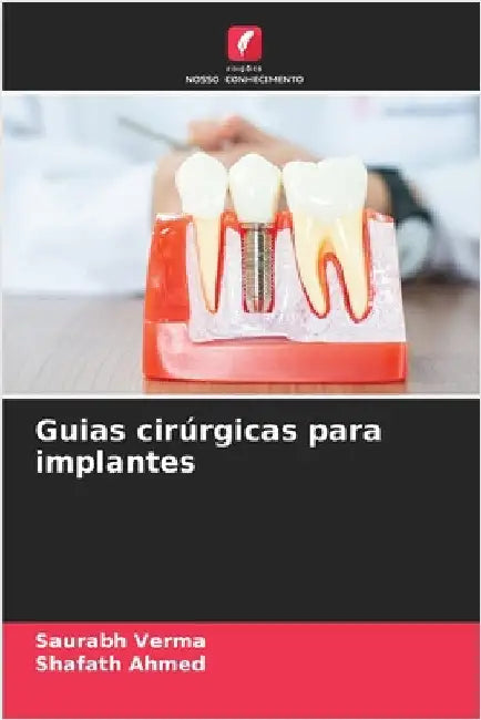Guias cirúrgicas para implantes by Saurabh Verma