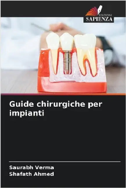 Guide chirurgiche per impianti by Verma, Saurabh