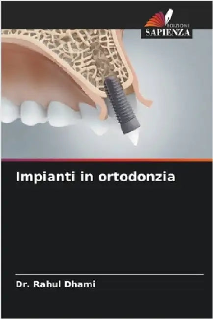 Impianti in ortodonzia by Rahul Dhami