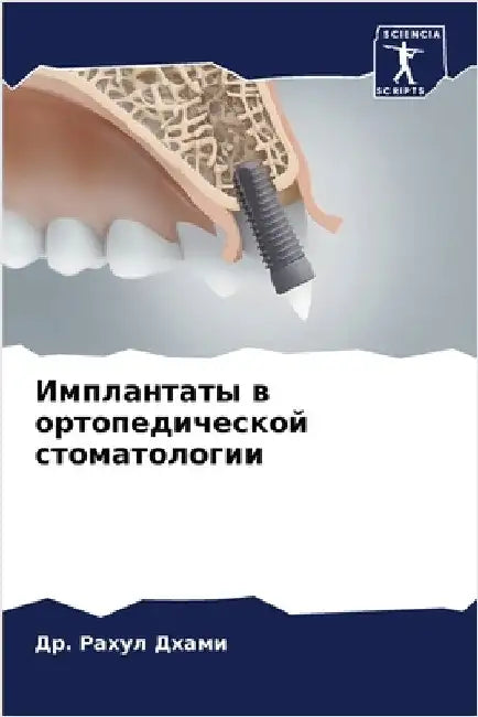 Имплантаты в ортопедиче& by  Дхами