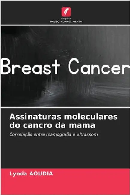 Assinaturas moleculares do cancro da mama by Aoudia, Lynda