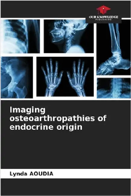 Imaging osteoarthropathies of endocrine origin by Aoudia, Lynda