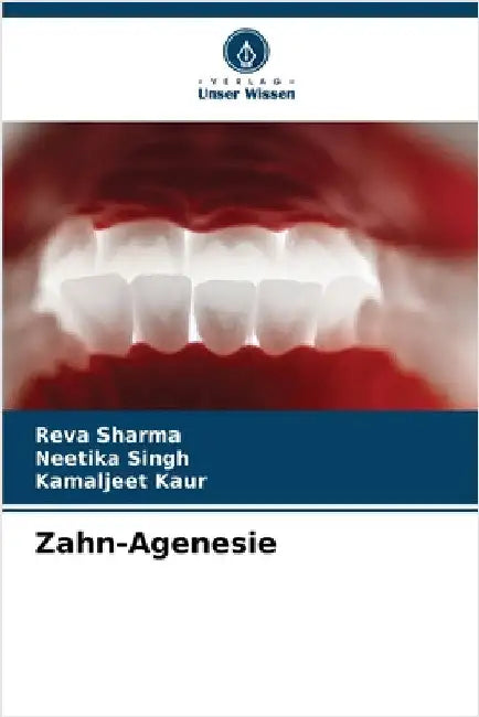 Zahn-Agenesie by Reva Sharma