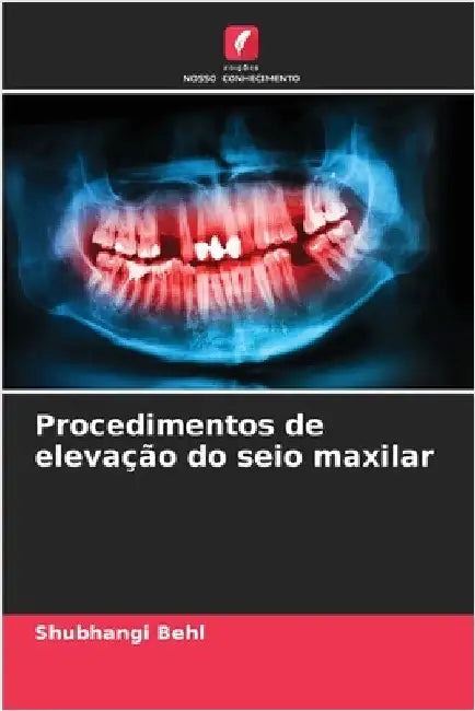 Procedimentos de elevação do seio maxilar by Shubhangi Behl