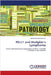 PD-L1 and Hodgkin's Lymphoma by Abdulrahman, Mohammed
