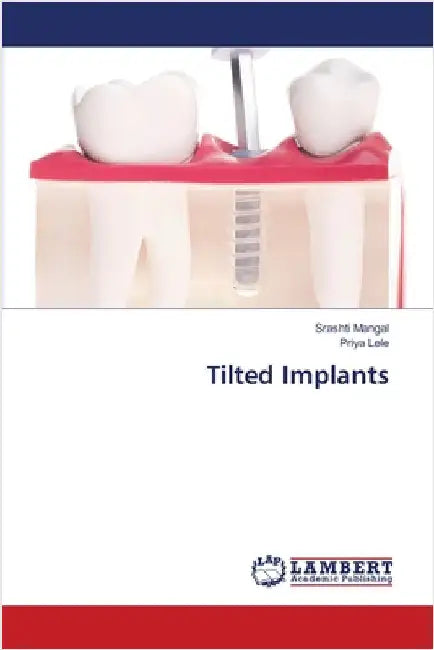 Tilted Implants by Srashti Mangal
