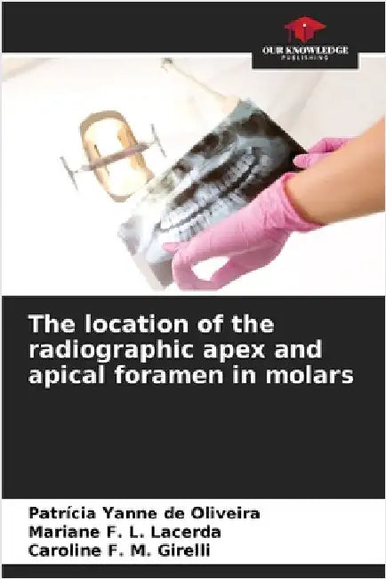 The location of the radiographic apex and apical foramen in molars by de Oliveira, Patrícia Yanne