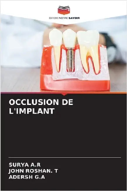 Occlusion de l'Implant by Surya A. R.