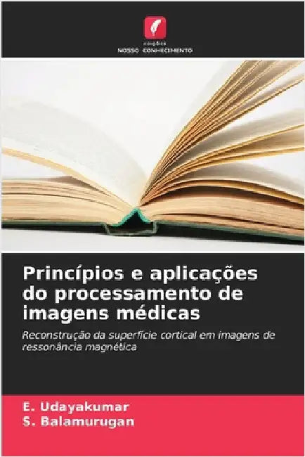 Princípios e aplicações do processamento de imagens médicas by Udayakumar, E.