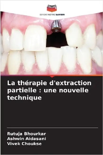 La thérapie d'extraction partielle: une nouvelle technique by Bhourkar, Rutuja