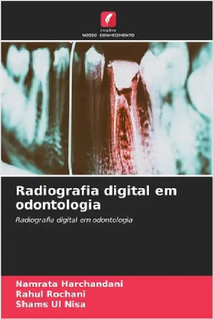 Radiografia digital em odontologia by Harchandani, Namrata
