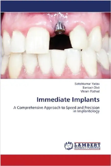 Immediate Implants by Satishkumar Yadav
