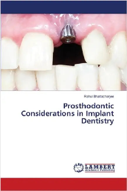 Prosthodontic Considerations in Implant Dentistry by Bhattacharjee, Rahul