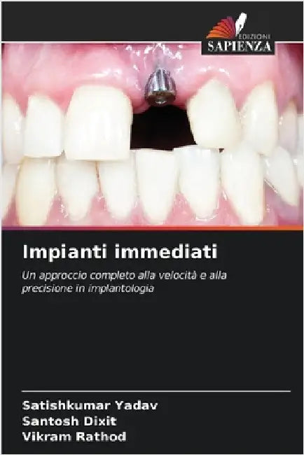 Impianti immediati by Satishkumar Yadav