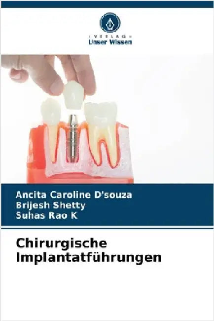 Chirurgische Implantatführungen by D'Souza, Ancita Caroline