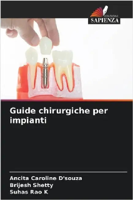 Guide chirurgiche per impianti by D'Souza, Ancita Caroline