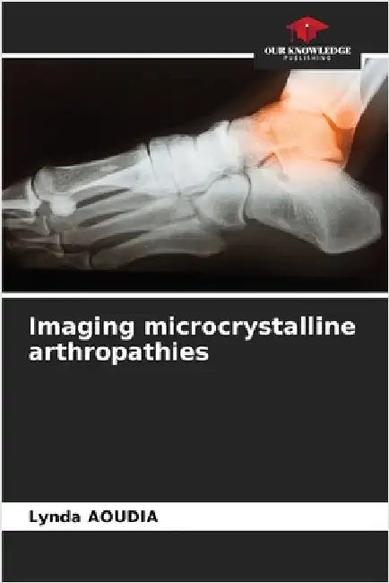 Imaging microcrystalline arthropathies by Aoudia, Lynda