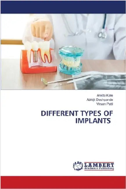 Different Types of Implants by Ankita Kale
